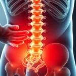 Incapacidad por hernia discal: causas y tratamiento